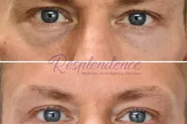 Resplendence MedSpa